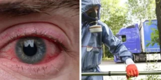 Trująca inwazja w Holandii: Eksperci ostrzegają przed wysypkami i problemami z oddychaniem